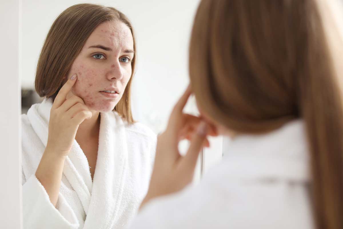 Young woman with acne problem near mirror in bathroom